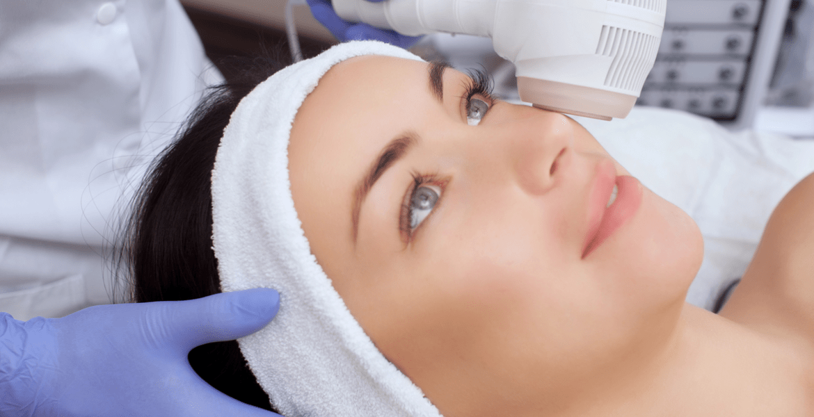 CryoSculpt